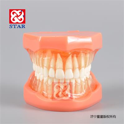 软牙龈可拔牙模型M7005