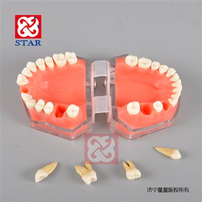 标准模型M7008硅胶牙龈可拔牙牙粒牙龈可更换